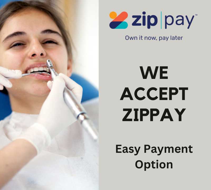 Zip Pay